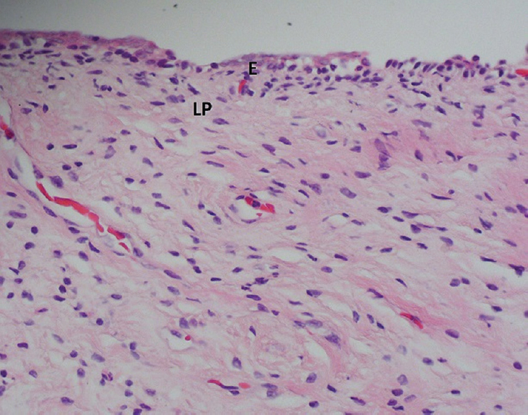 Vagina, haematoxylin-eosin staining, ×400. E, stratified squamous epithelium; LP, lamina propria.